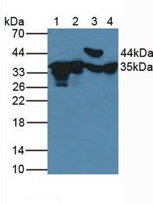 Polyclonal Antibody to Fructosamine-3-Kinase (FN3K)
