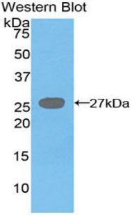 Polyclonal Antibody to Diacylglycerol-O-Acyltransferase Homolog 1 (DGAT1)