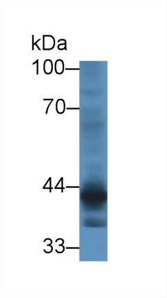 Polyclonal Antibody to Cartilage Associated Protein (CRTAP)