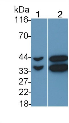 Polyclonal Antibody to Calponin 1, Basic (CNN1)