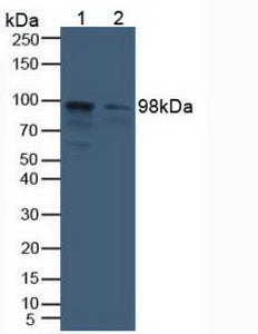 Polyclonal Antibody to Aconitase 1 (ACO1)