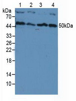 Polyclonal Antibody to Phosphoinositide-3-Kinase Catalytic Beta Polypeptide (PIK3Cb)