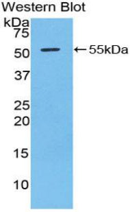 Polyclonal Antibody to Granzyme D (GZMD)