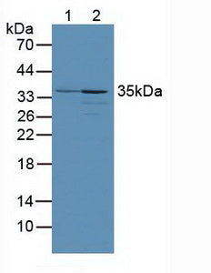 Polyclonal Antibody to PTEN Induced Putative Kinase 1 (PINK1)