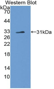 Polyclonal Antibody to Notch Homolog 4 (NOTCH4)