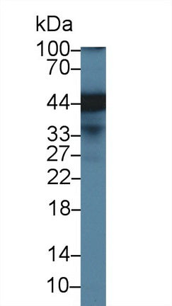 Polyclonal Antibody to Endoplasmic Reticulum Lipid Raft Associated Protein 2 (ERLIN2)
