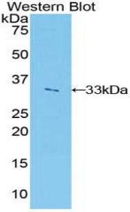 Polyclonal Antibody to Insulin Like Growth Factor 2 mRNA Binding Protein 2 (IGF2BP2)