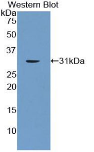 Polyclonal Antibody to Leucine Rich Repeats And Immunoglobulin Like Domains Protein 1 (LRIG1)