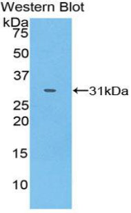 Polyclonal Antibody to Src Homology 2 Domain Containing Adapter Protein B (SHB)
