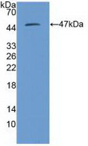 Polyclonal Antibody to Proteasome 26S Subunit, Non ATPase 13 (PSMD13)