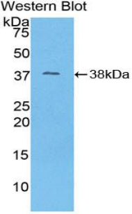 Polyclonal Antibody to NADH Dehydrogenase 1 (ND1)