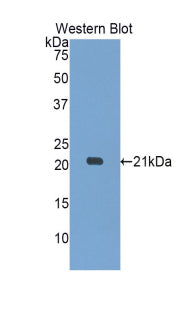 Polyclonal Antibody to Myosin Light Chain 12A (MYL12A)