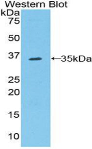 Polyclonal Antibody to Raft Linking Protein (Raftlin)