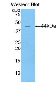 Polyclonal Antibody to Lipocalin 15 (LCN15)