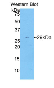 Polyclonal Antibody to A Disintegrin And Metalloprotease 6 (ADAM6)