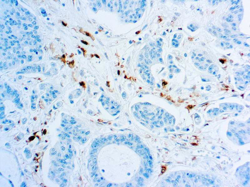 Thymidine Phosphorylase