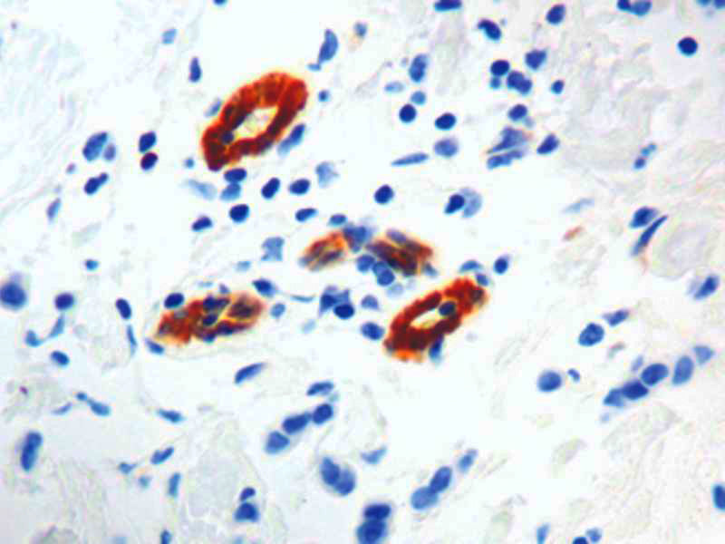 Transglutaminase II