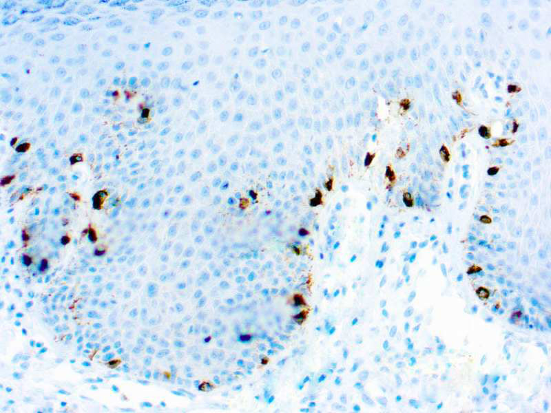 Tyrosinase