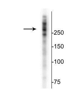 Anti-Microtubule Associated Protein 2 (MAP2) Antibody 1 Citation