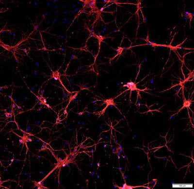 Anti-Microtubule Associated Protein 2 (MAP2) Antibody 1 Citation