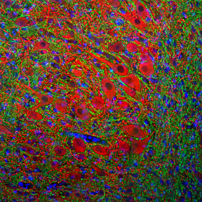 Anti-Microtubule Associated Protein 2 (MAP2) Antibody 1 Citation