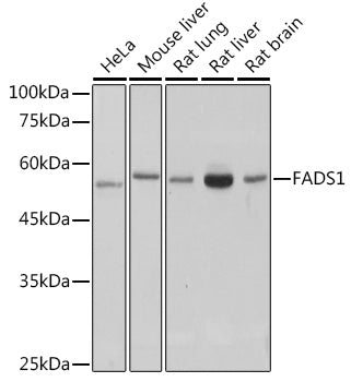 FADS1 Rabbit mAb