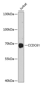CCDC61 Rabbit pAb