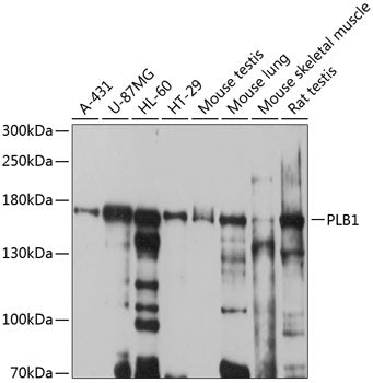 PLB1 Rabbit pAb