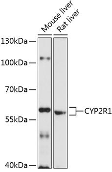 CYP2R1 Rabbit pAb