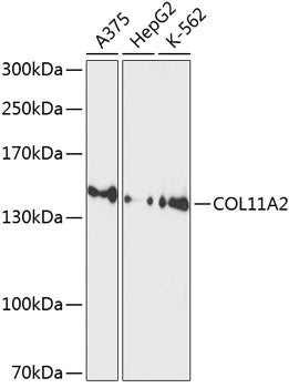 COL11A2 Rabbit pAb