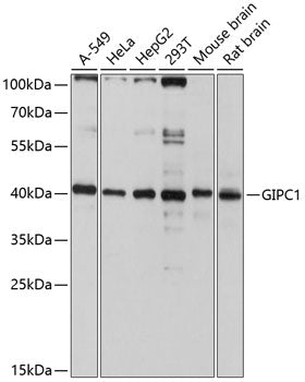GIPC1 Rabbit pAb