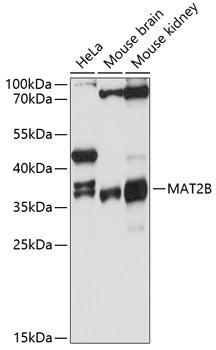 MAT2B Rabbit pAb