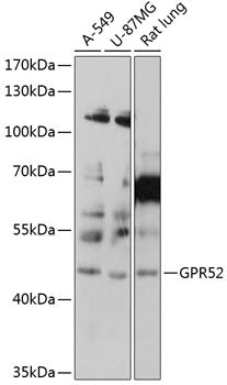 GPR52 Rabbit pAb