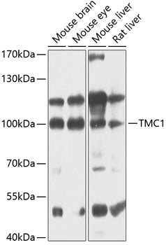 TMC1 Rabbit pAb