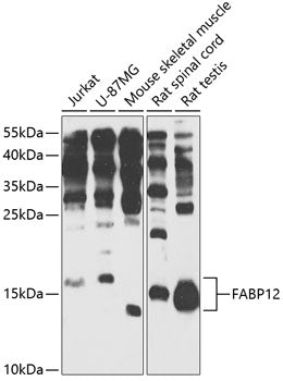 FABP12 Rabbit pAb