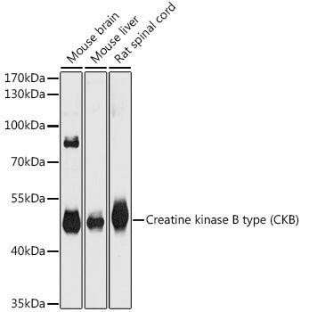 Creatine kinase B type (CKB) Rabbit pAb