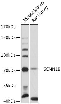 SCNN1B Rabbit pAb