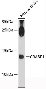 CRABP1 Rabbit pAb