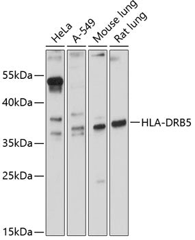 HLA-DRB5 Rabbit pAb