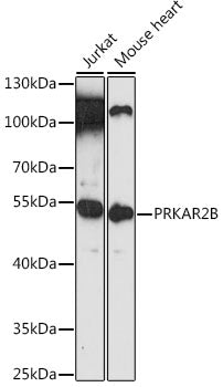 PRKAR2B Rabbit pAb