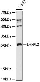 LHFPL2 Rabbit pAb