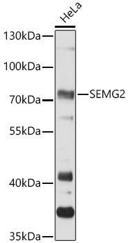 SEMG2 Rabbit pAb