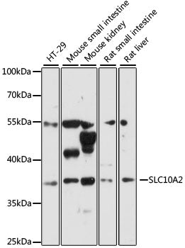 SLC10A2 Rabbit pAb