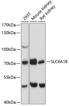 SLC6A18 Rabbit pAb
