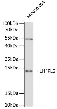 LHFPL2 Rabbit pAb
