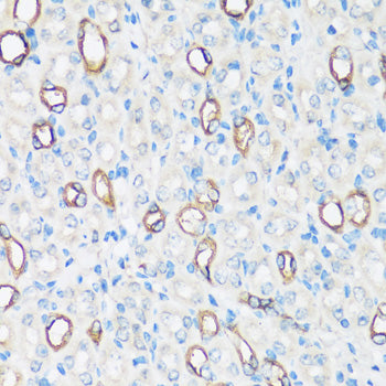 AQP2 Rabbit pAb