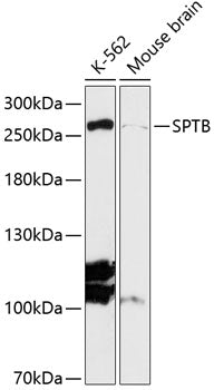 SPTB Rabbit pAb