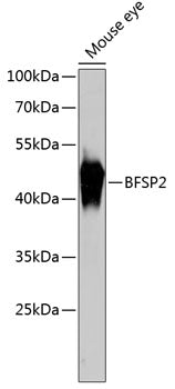 BFSP2 Rabbit pAb