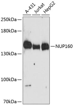 NUP160 Rabbit pAb