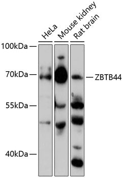 ZBTB44 Rabbit pAb